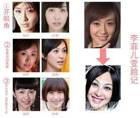 西安整容爆料事件视频最新,揭秘行业乱象,患者权益引关注